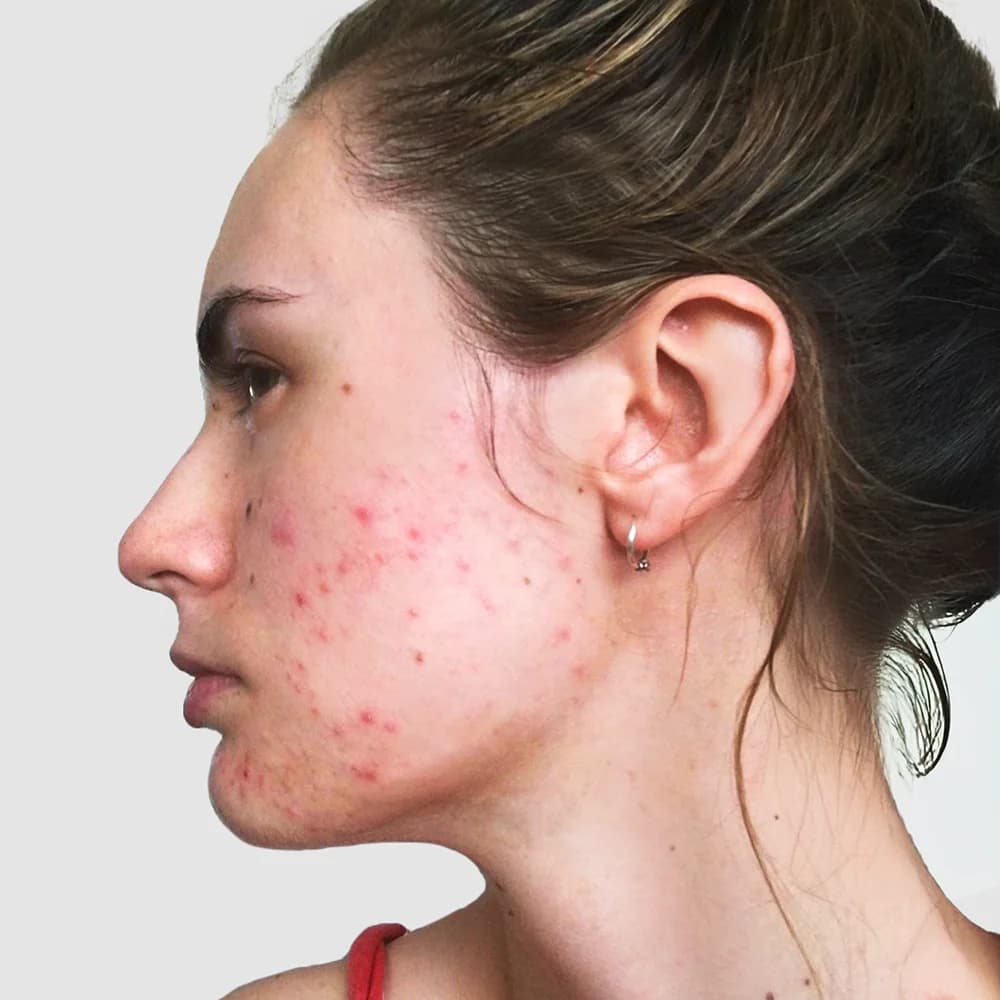 Why I created All You Can Face