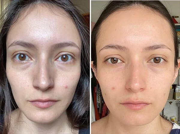 DARK CIRCLES after