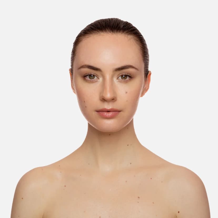 DARK CIRCLES