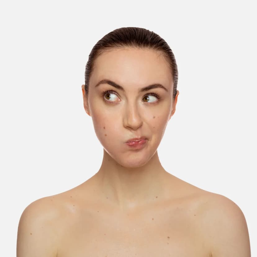LIP LINES