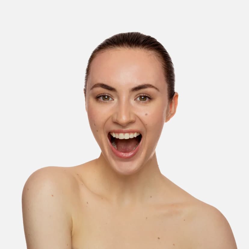 SMILE LINES