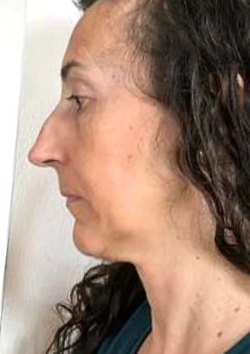 Before transformation