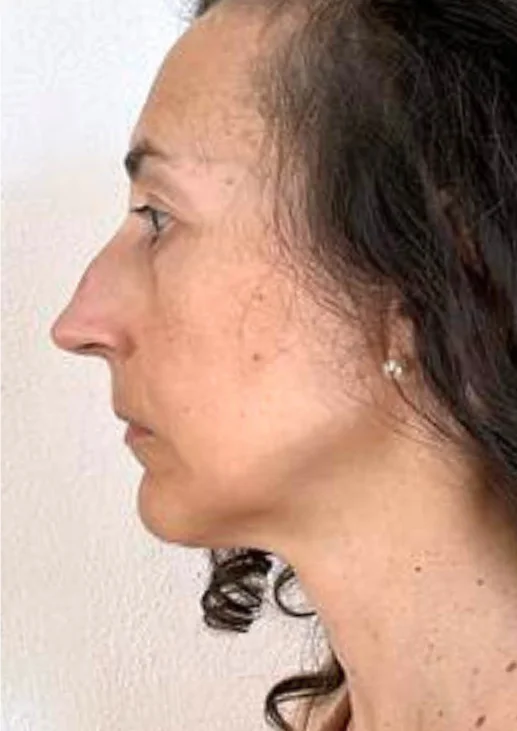 After transformation